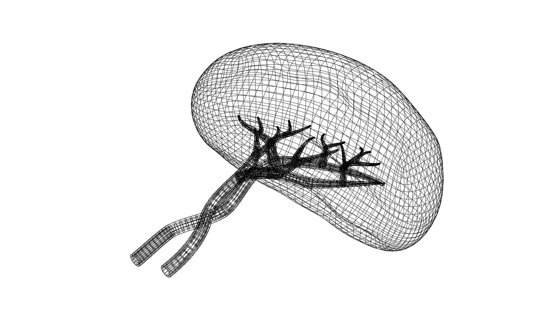 Human Spleen 3D model_4