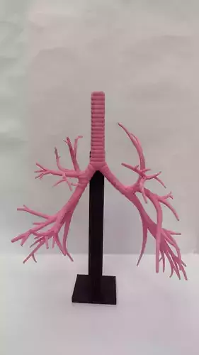   Bronchial tree with support 3D print model