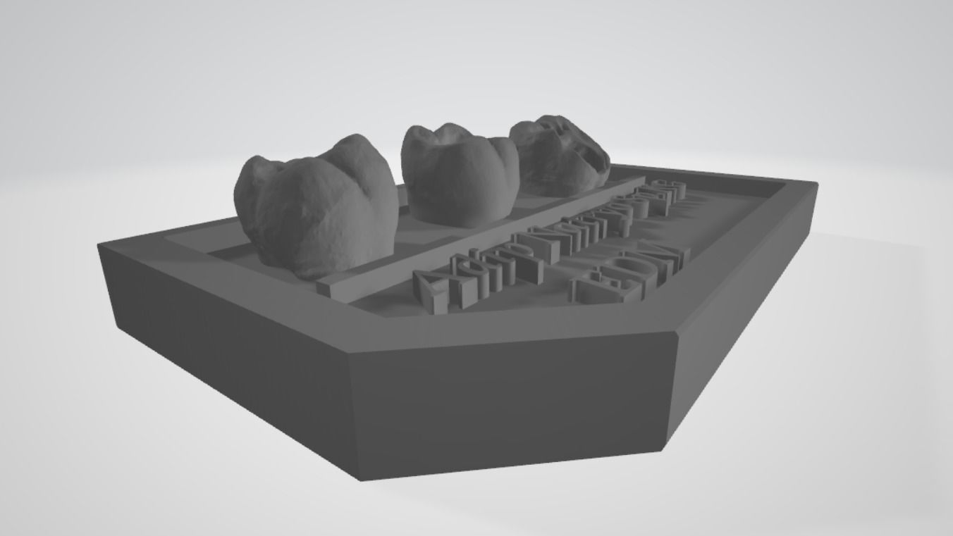 Posterior real case by EDM DENTAL PRACTICE 3D print model_5