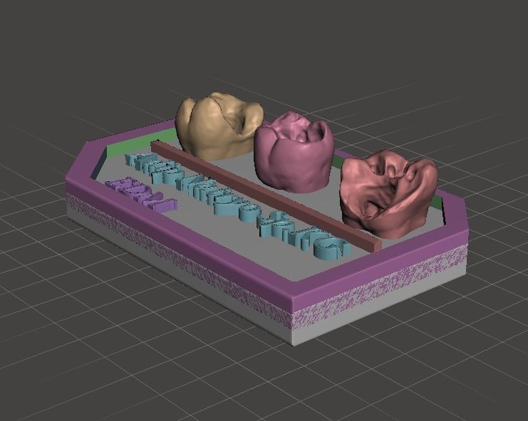 Posterior real case by EDM DENTAL PRACTICE 3D print model_8