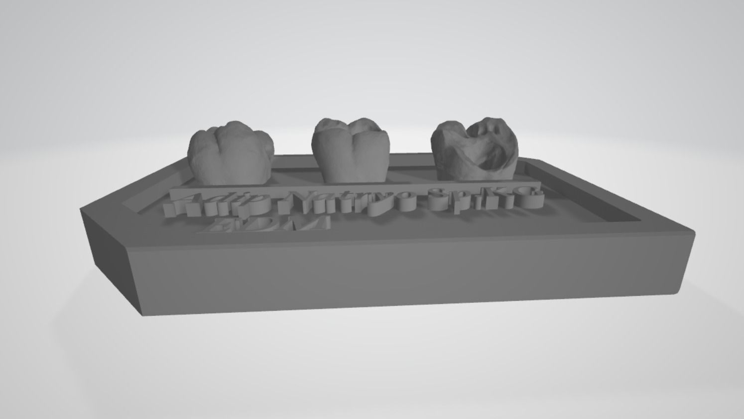 Posterior real case by EDM DENTAL PRACTICE 3D print model_2