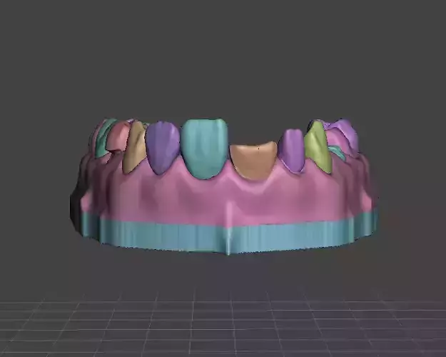 Segmented Full Mixed Arch Complex Cases by EDM DENTAL PRACTICE 3D print model
