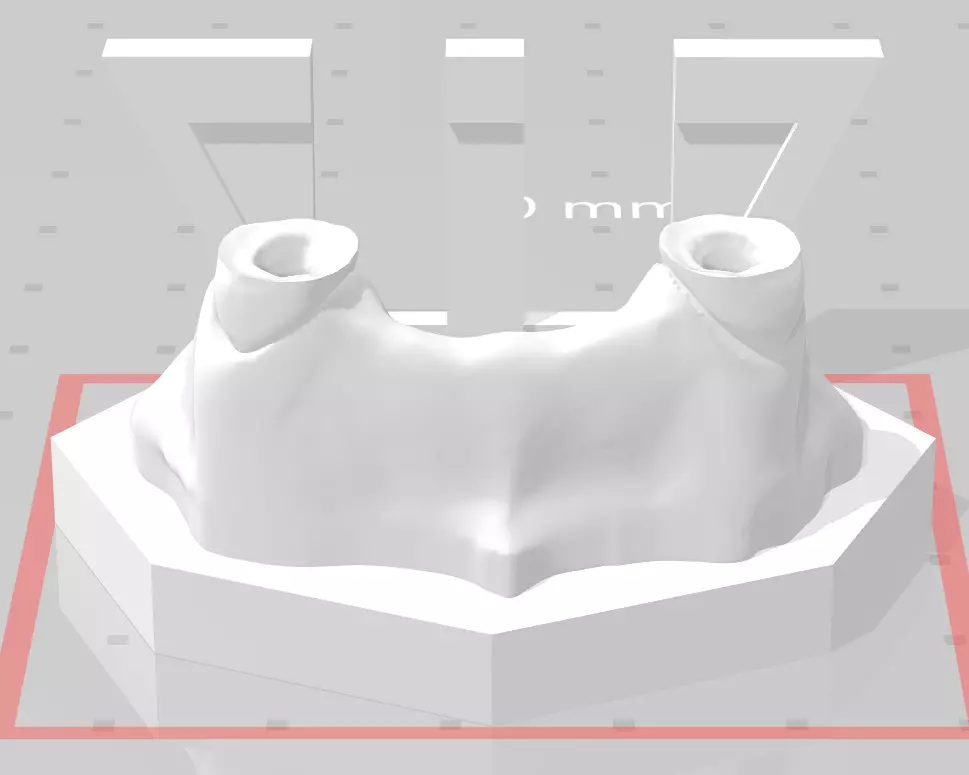 Segmented Canine Decaputation with Root Canal by EDM DENTAL 3D print model_0