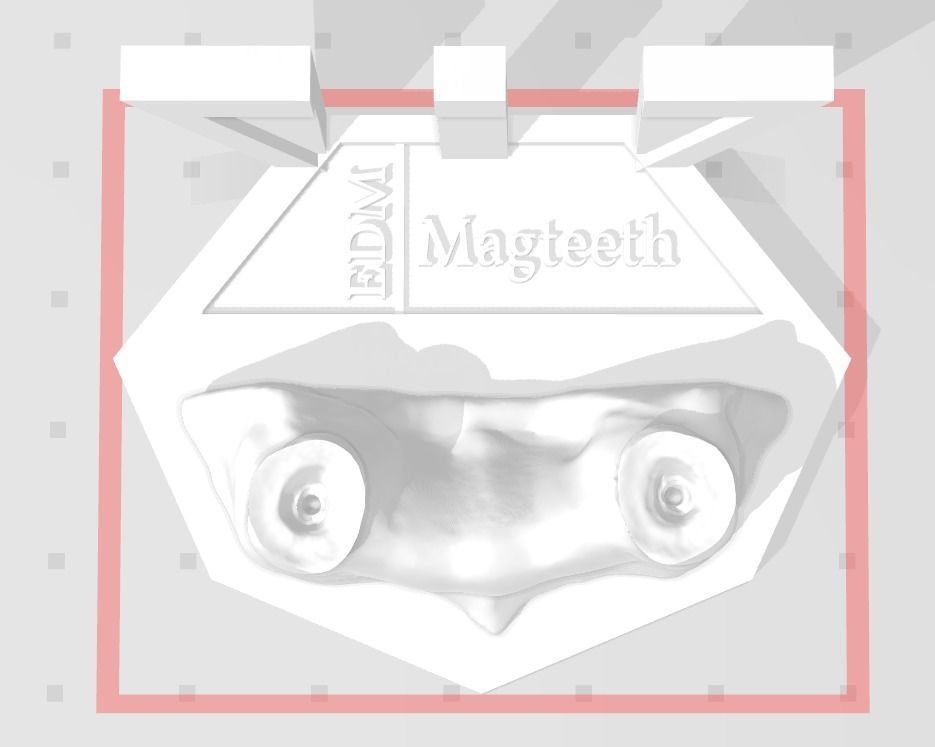 Segmented Canine Decaputation with Root Canal by EDM DENTAL 3D print model_2