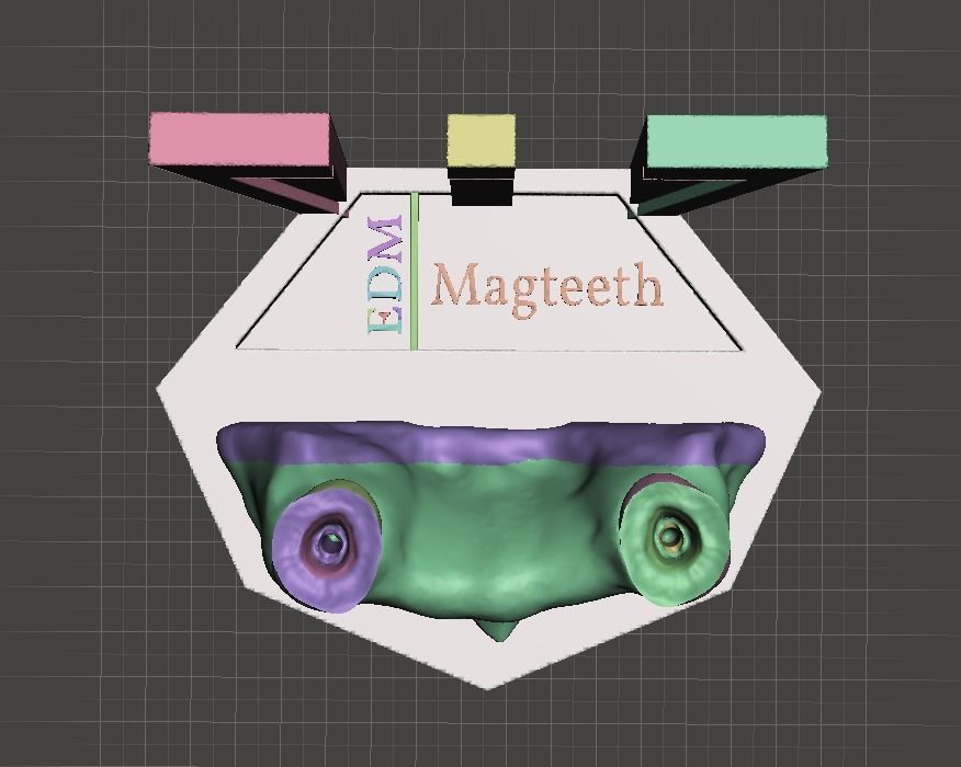 Segmented Canine Decaputation with Root Canal by EDM DENTAL 3D print model_3