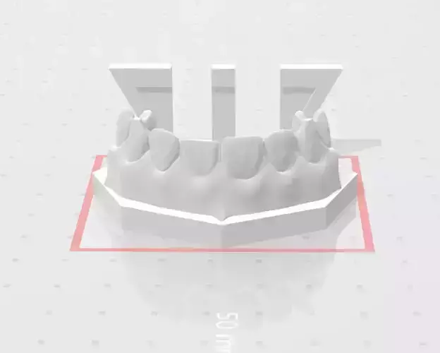 Segmented Anterior Direct Veneer by EDM DENTAL PRACTICE 3D print model