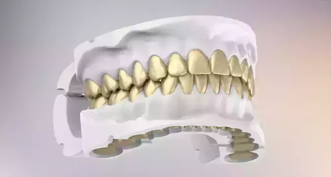 3D Dental Jaws Replica with Detachable Teeth 3D print model