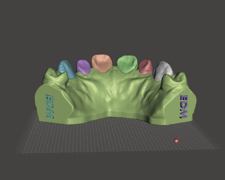 Segmented Anterior Veneer Preparation by EDM DENTAL PRACTICE 3D print model_7