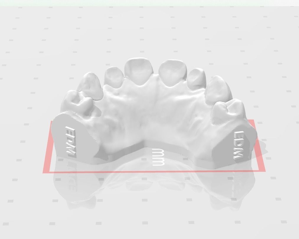 Segmented Anterior Veneer Preparation by EDM DENTAL PRACTICE 3D print model_6