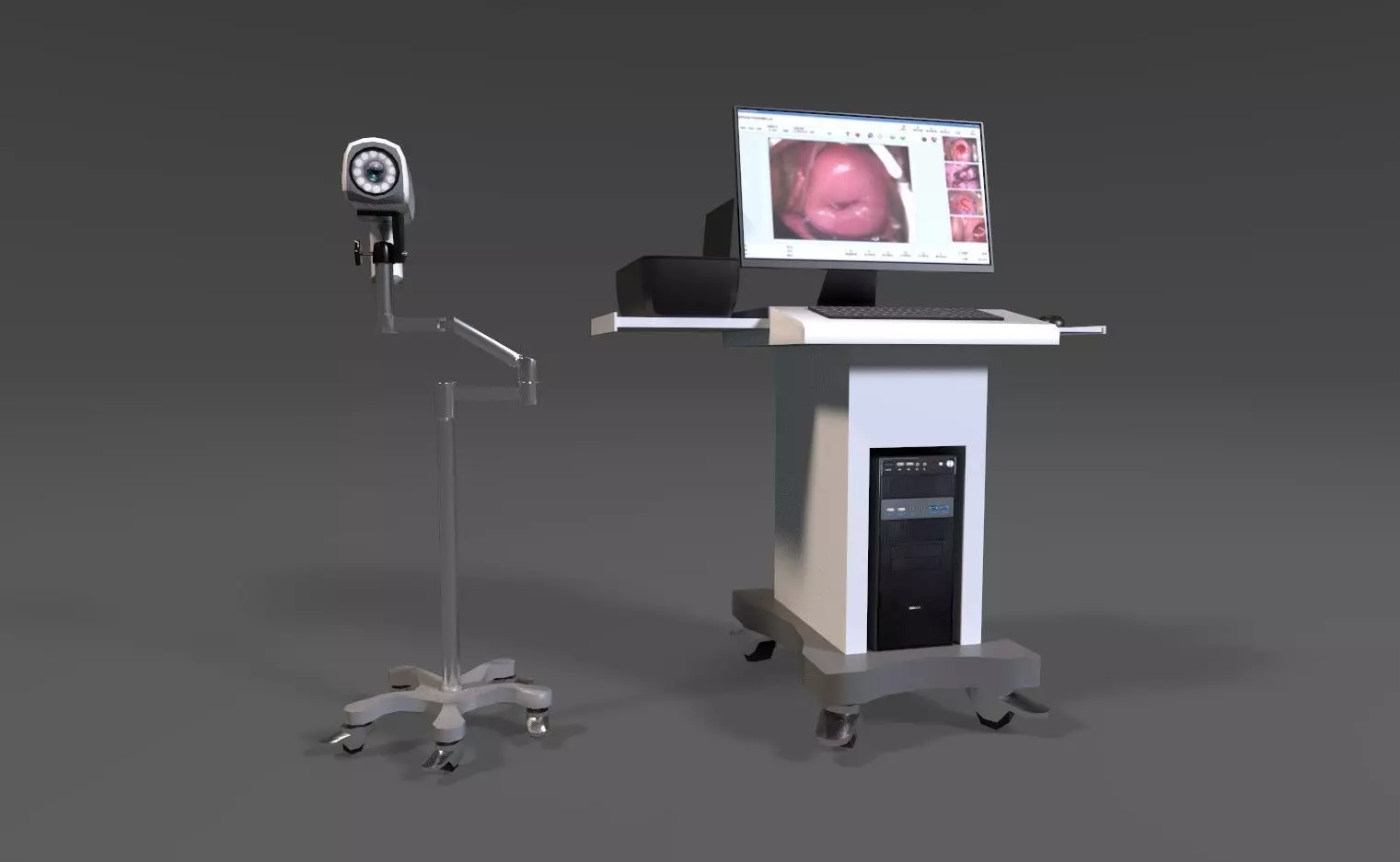 Colposcope camera and monitor Low-poly 3D model_0