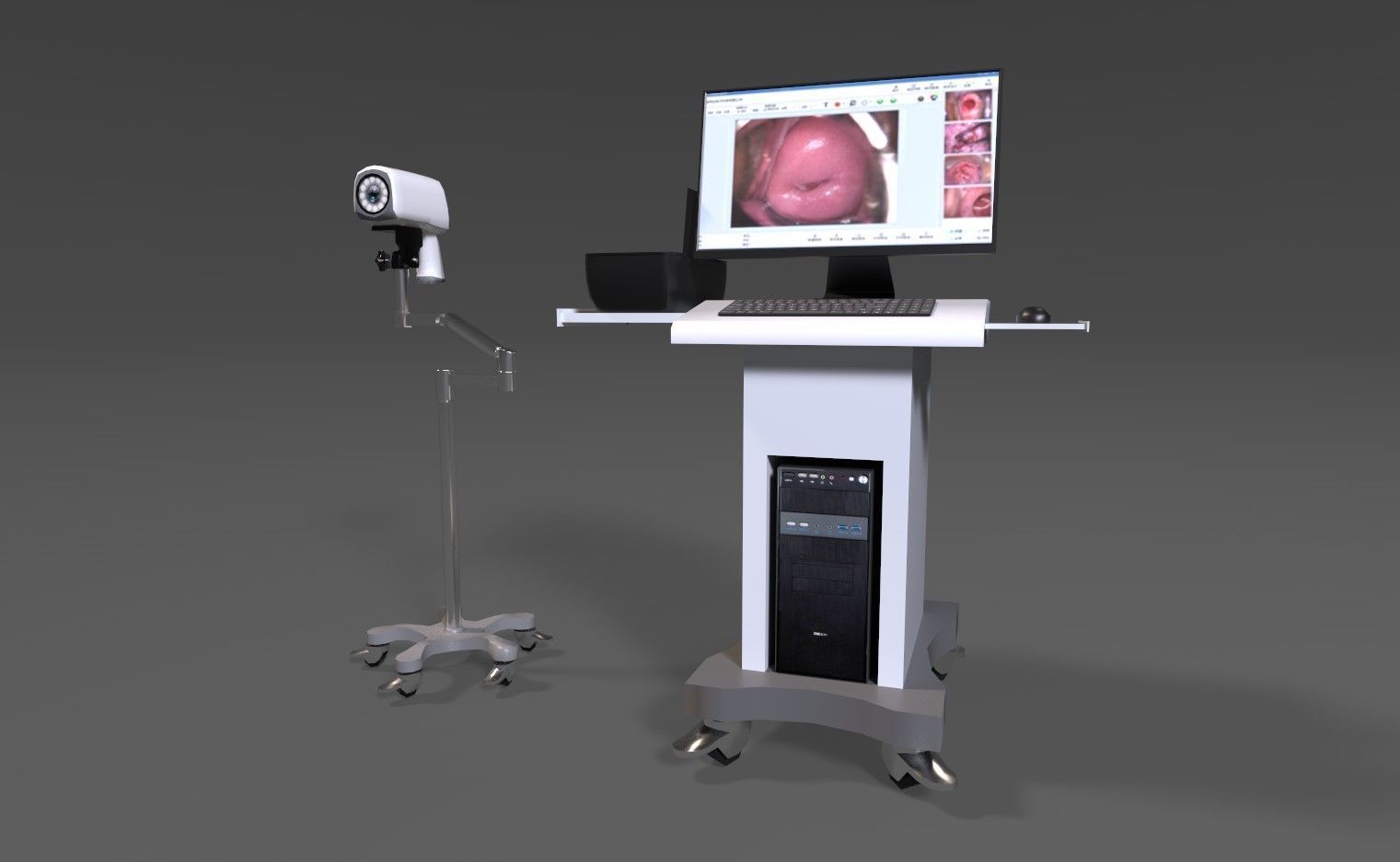 Colposcope camera and monitor Low-poly 3D model_1