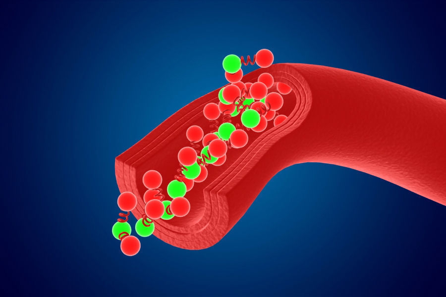 Artery Vein Clog Clot Clogged Stream Bloodflow Layers Section 3D model_1