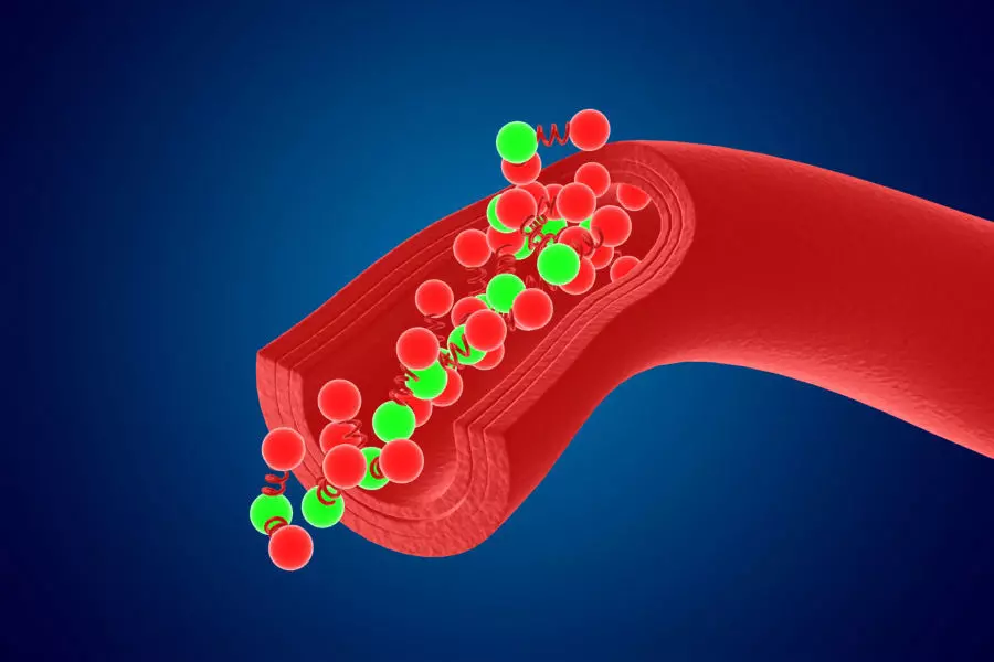 Artery Vein Clog Clot Clogged Stream Bloodflow Layers Section 3D model_0