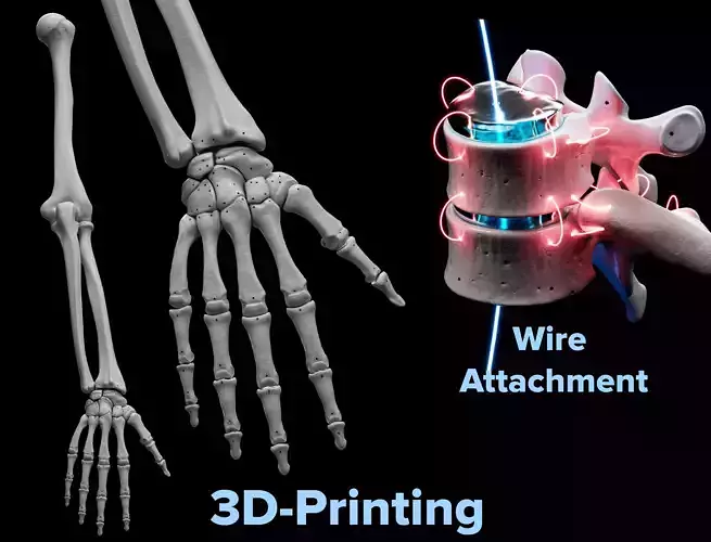 Human Rt Arm and Hand bones
