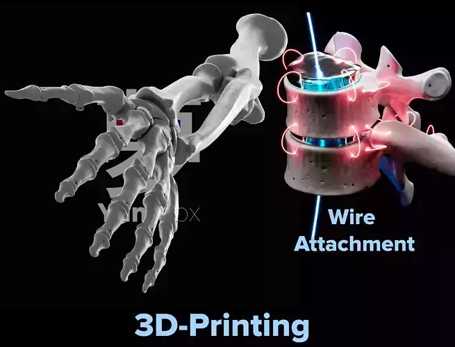 Human Lt Arm and Hand Bones