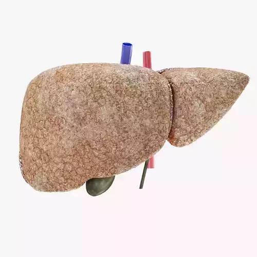 Fibrosis Liver 3D model