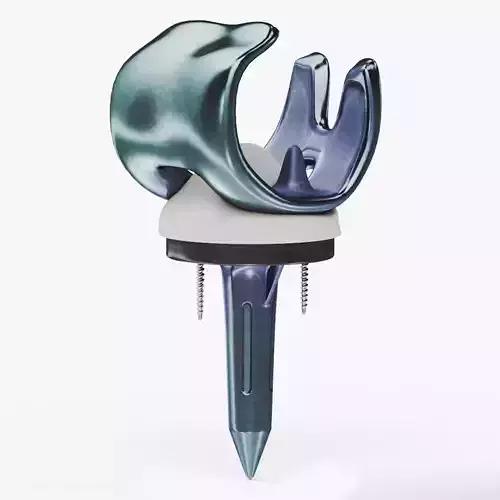 knee Implant Low-poly 3D model