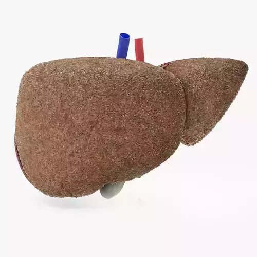 Steatohepatitis Liver