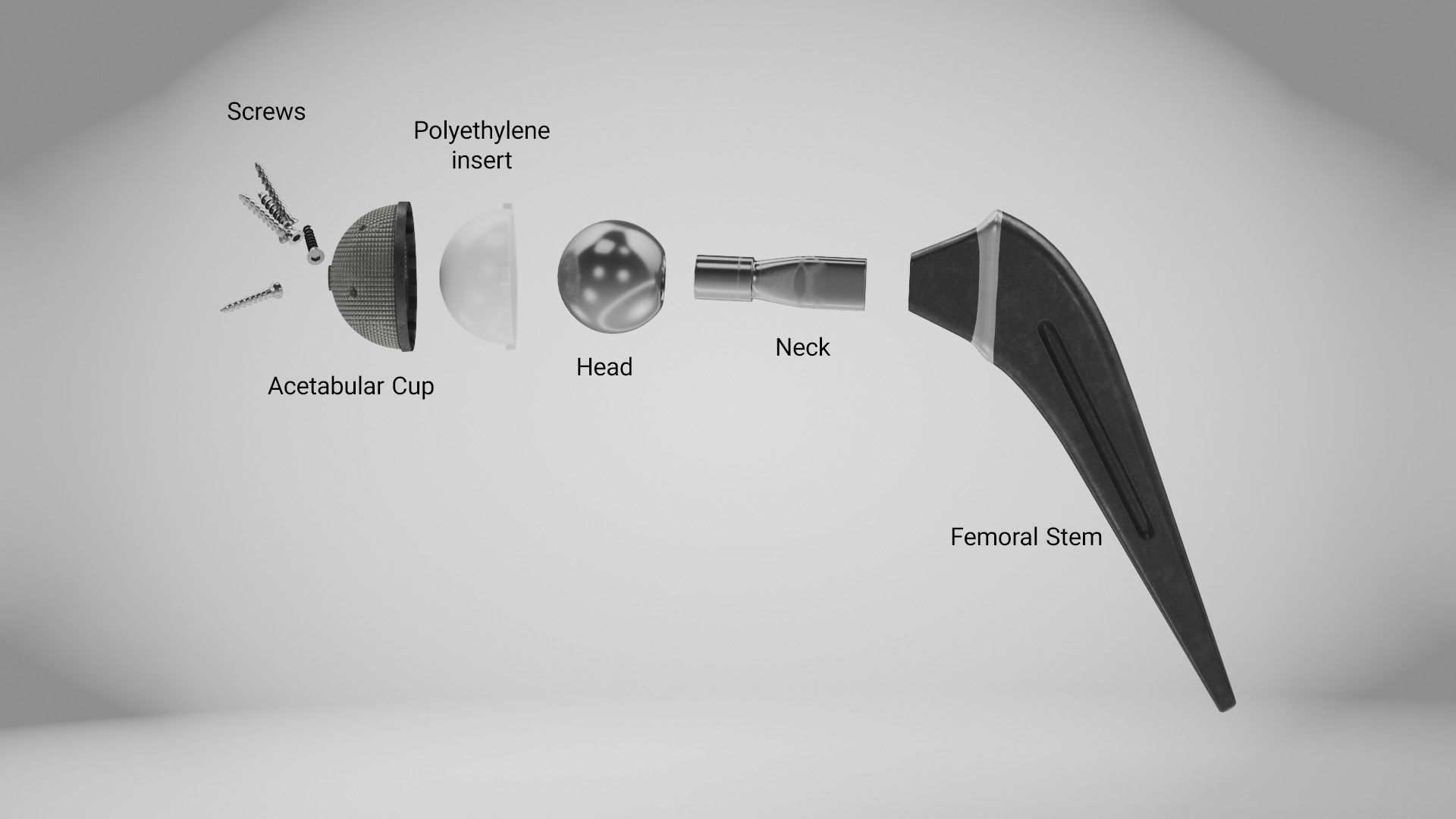 Replaced Hip Implant Low-poly 3D model_9