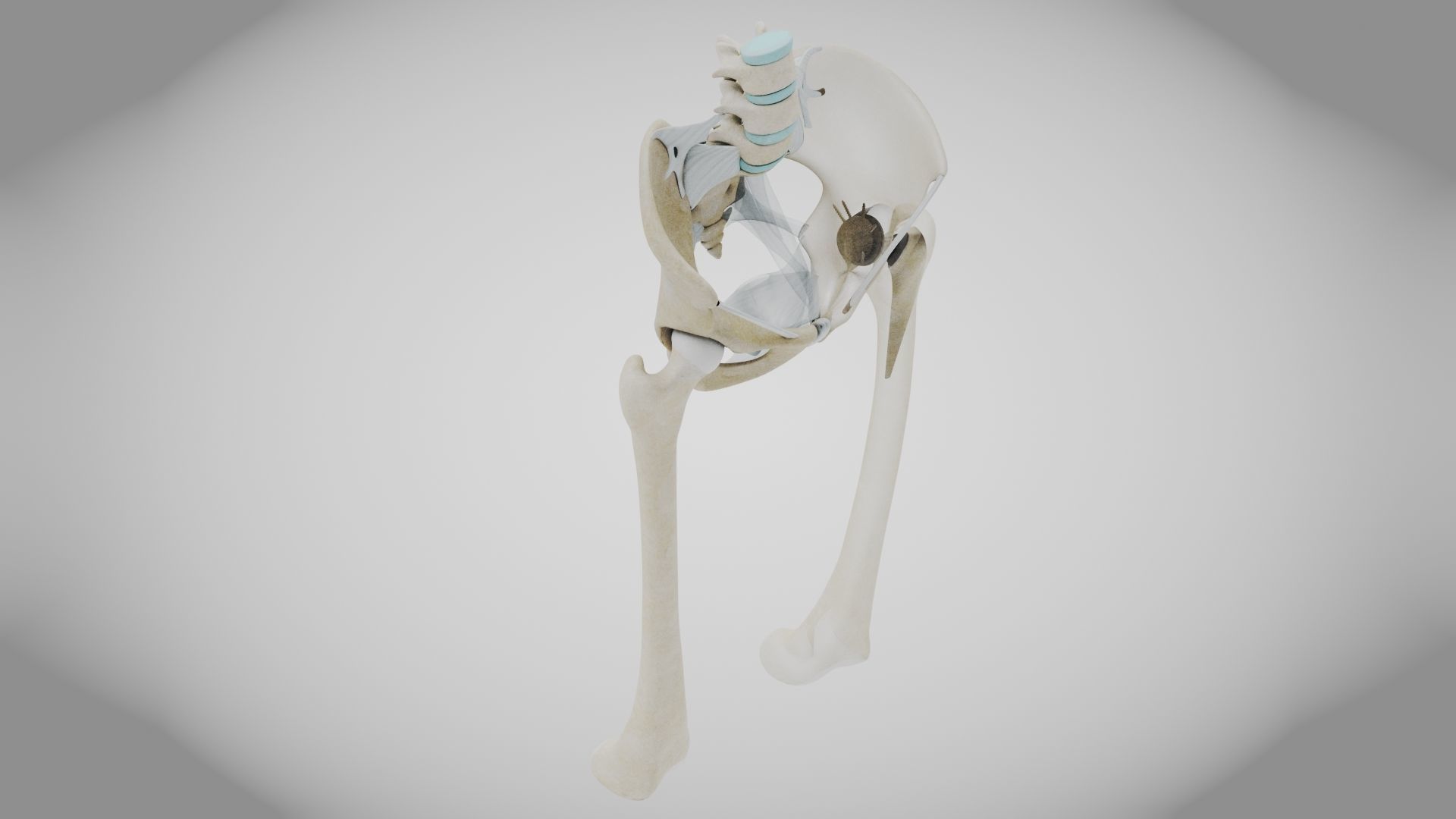 Replaced Hip Implant Low-poly 3D model_24