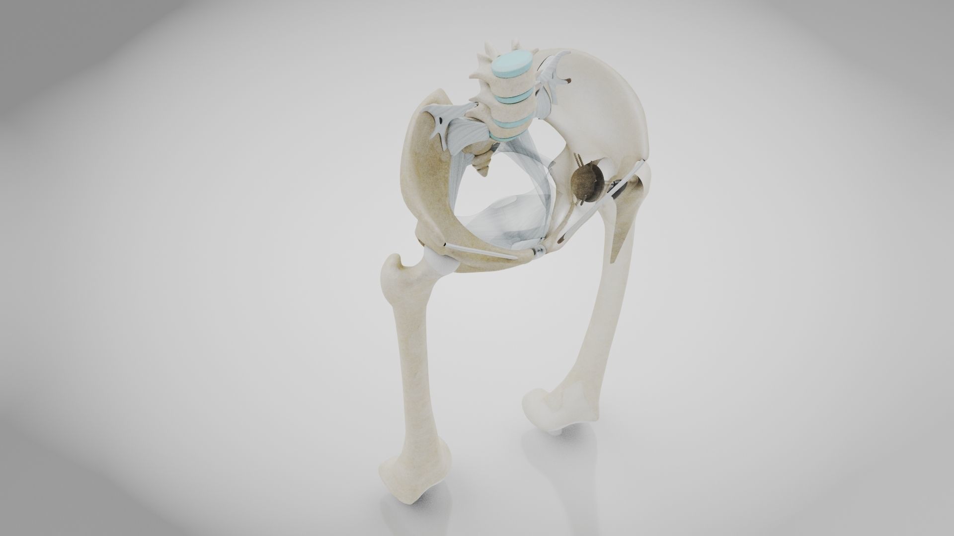 Replaced Hip Implant Low-poly 3D model_27