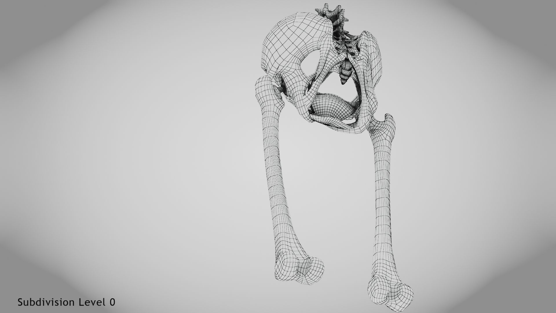 Replaced Hip Implant Low-poly 3D model_46