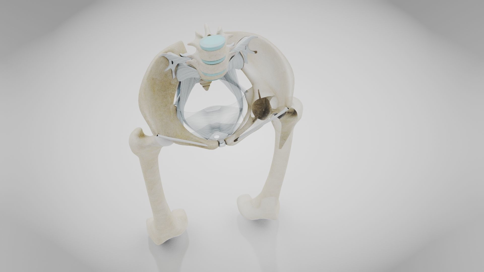 Replaced Hip Implant Low-poly 3D model_29