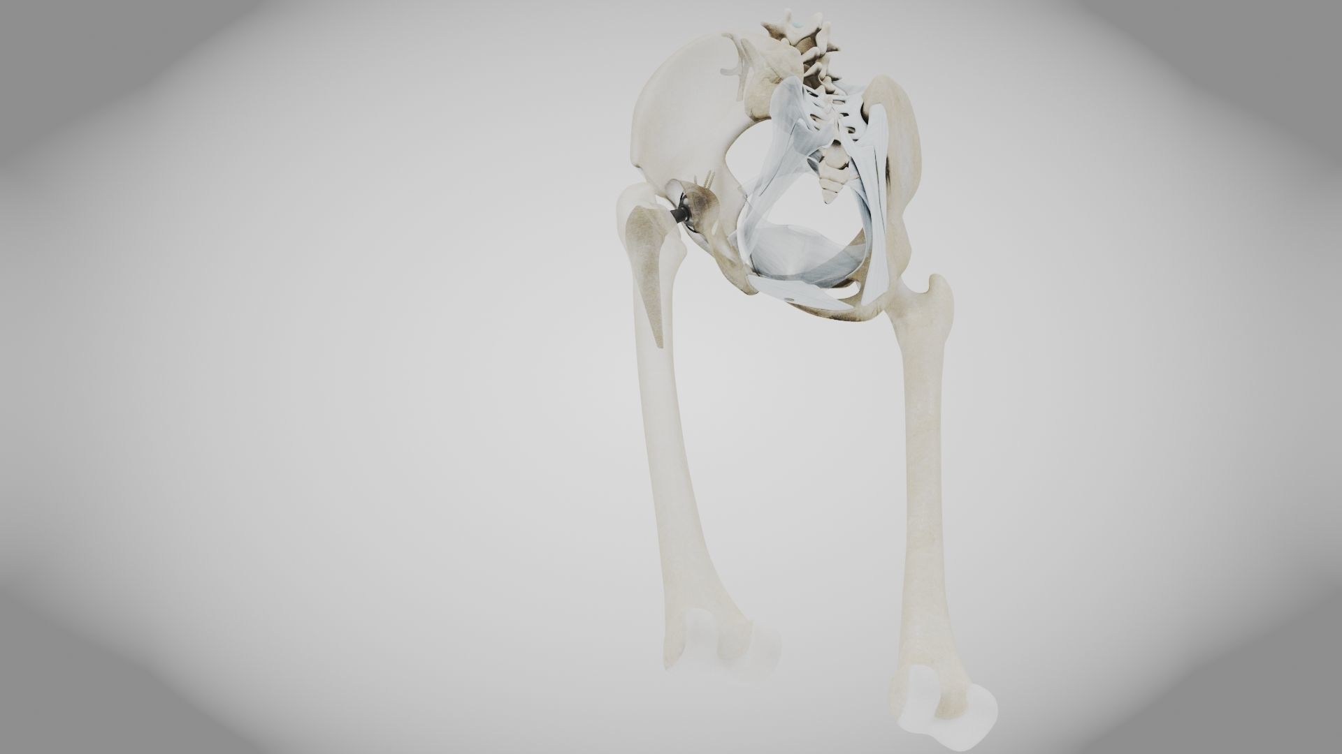 Replaced Hip Implant Low-poly 3D model_18