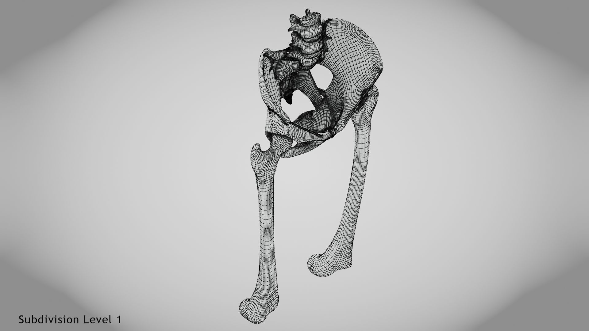 Replaced Hip Implant Low-poly 3D model_51