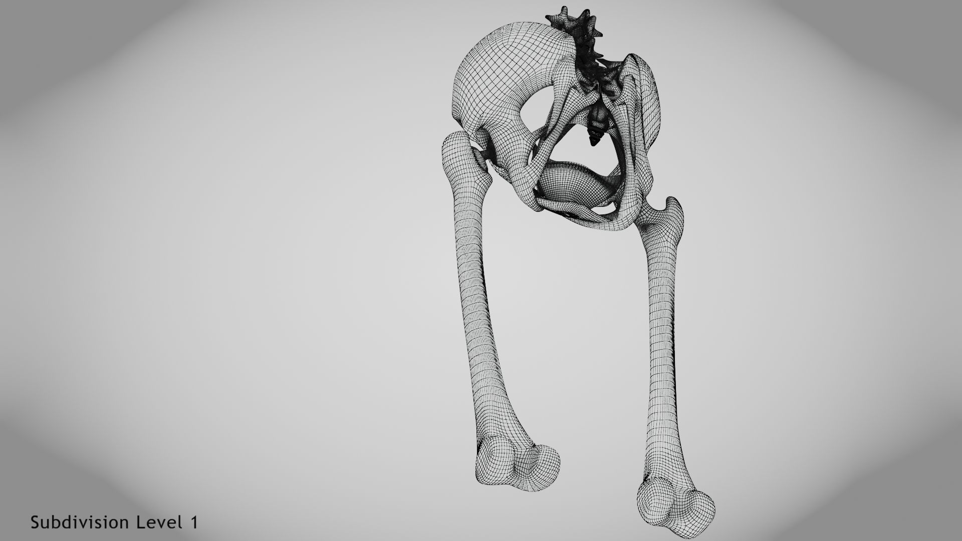 Replaced Hip Implant Low-poly 3D model_47