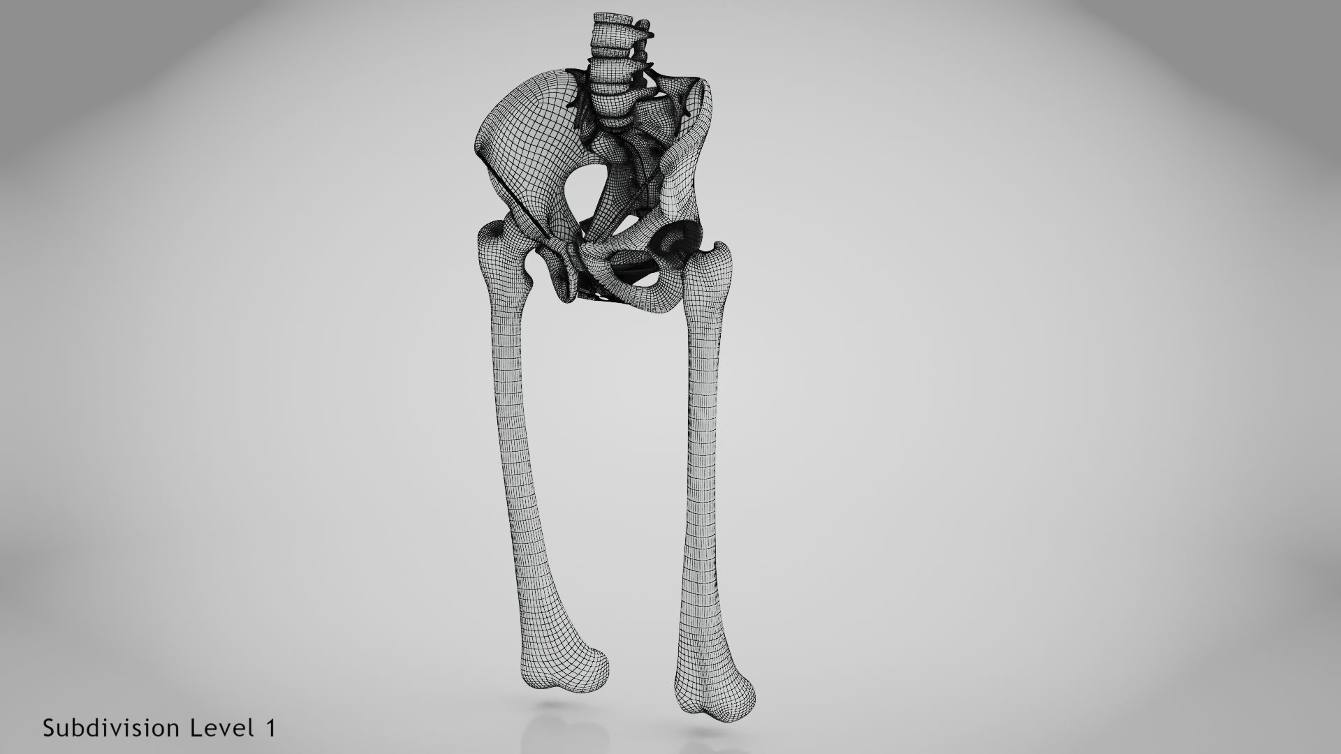 Replaced Hip Implant Low-poly 3D model_43