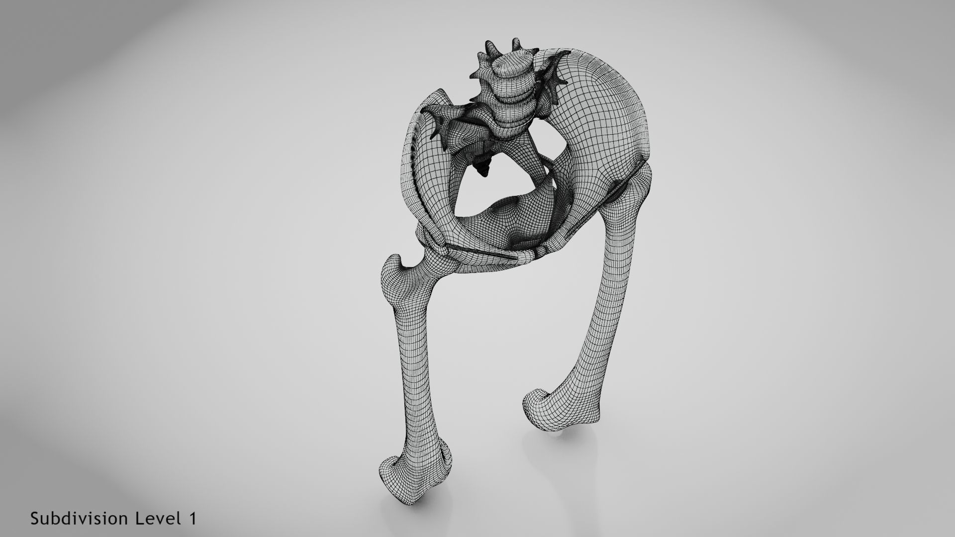 Replaced Hip Implant Low-poly 3D model_49