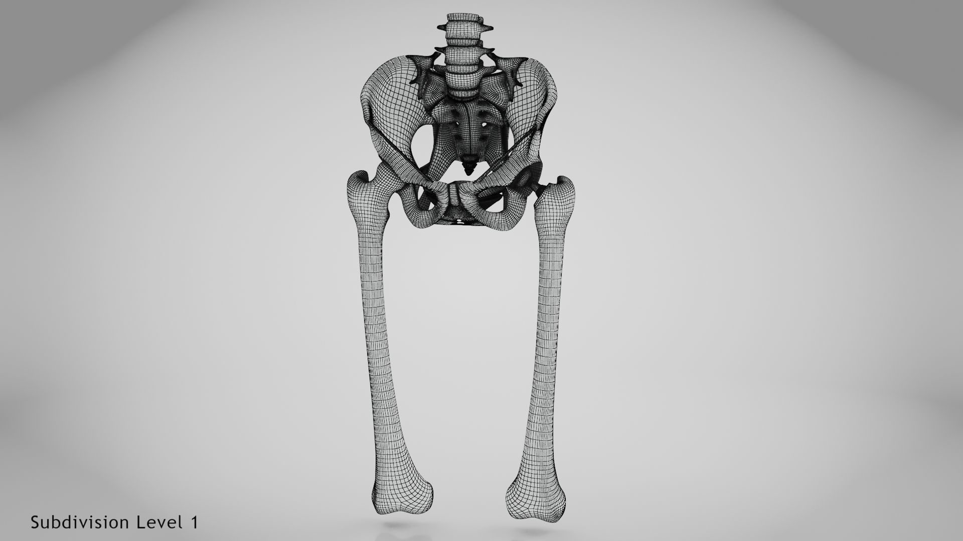 Replaced Hip Implant Low-poly 3D model_45