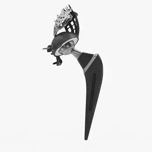 Pelvic Implant 3D model