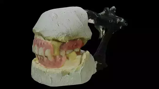 Teeth denture scan