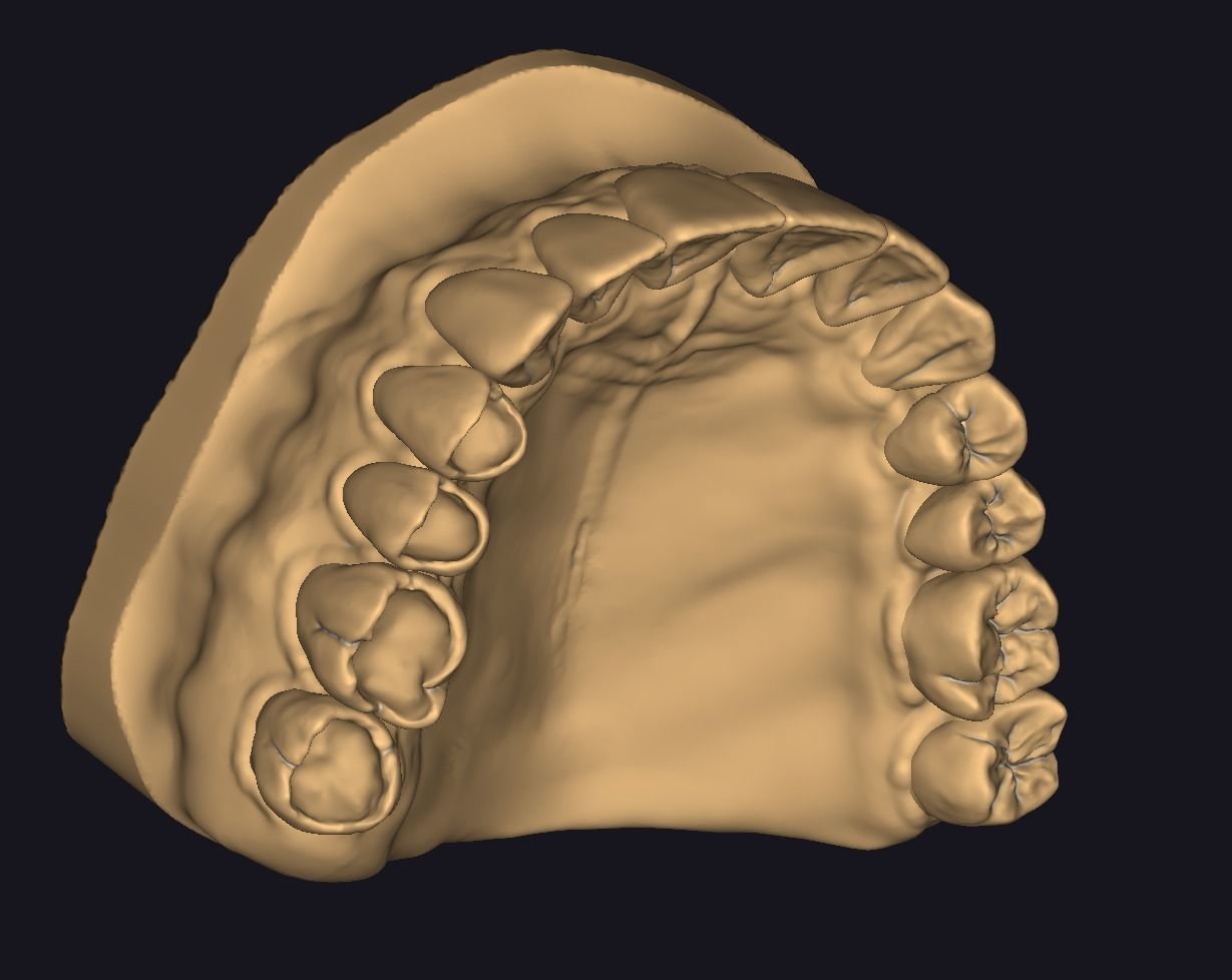 Model for occlusal restoration study and training 3D print model_1