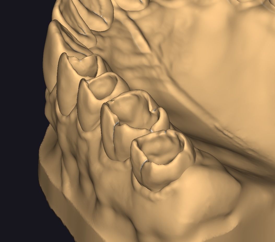 Model for occlusal restoration study and training 3D print model_4