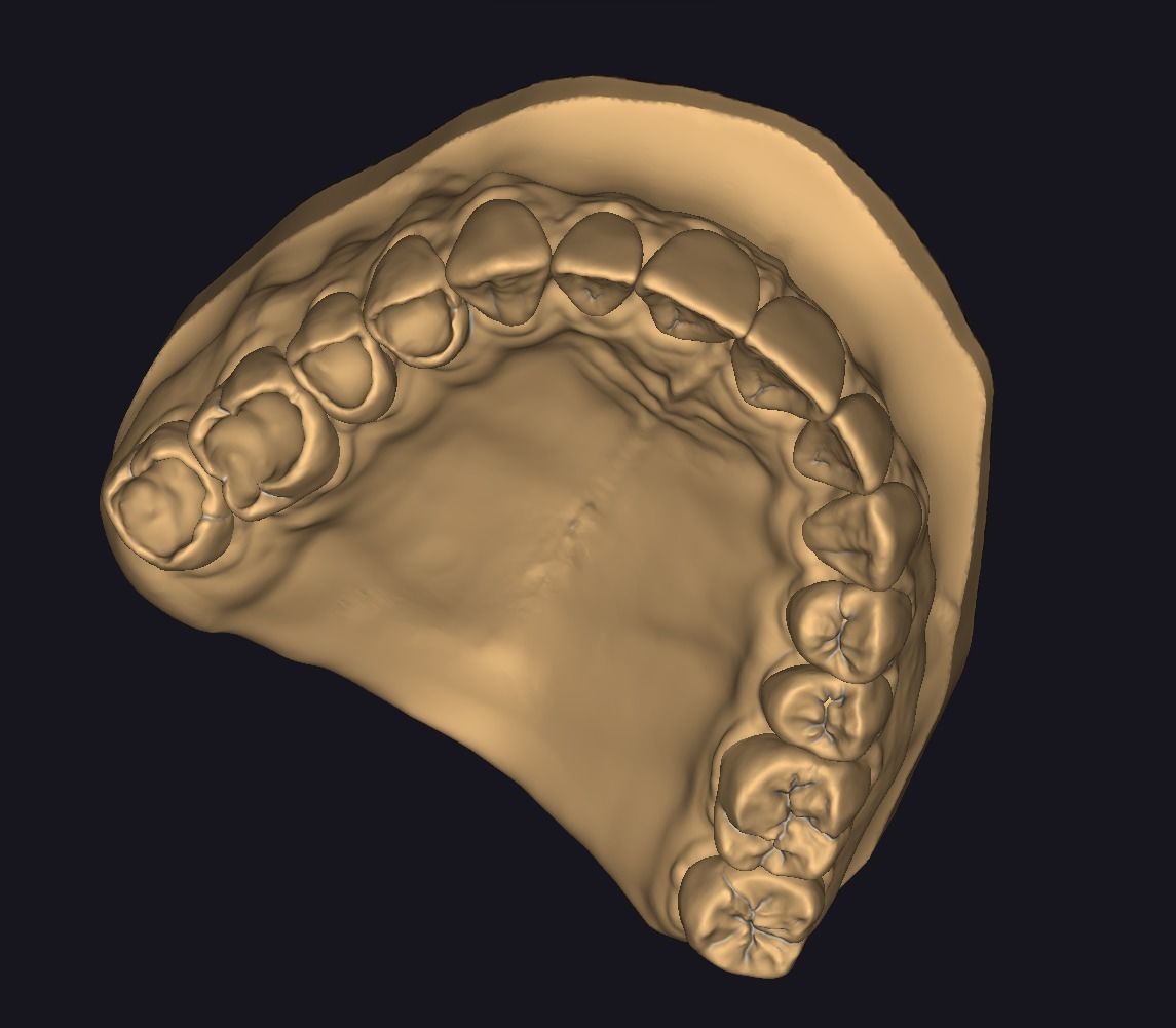 Model for occlusal restoration study and training 3D print model_3