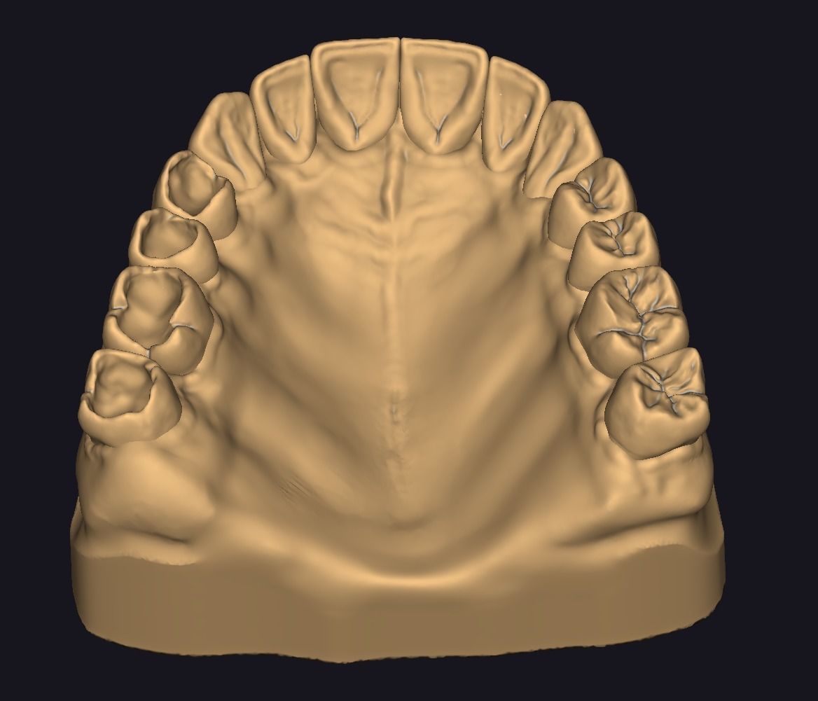 Model for occlusal restoration study and training 3D print model_2