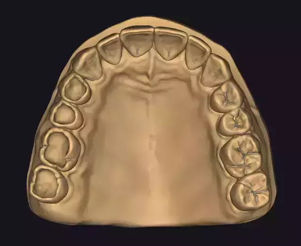 Model for occlusal restoration study and training 3D print model