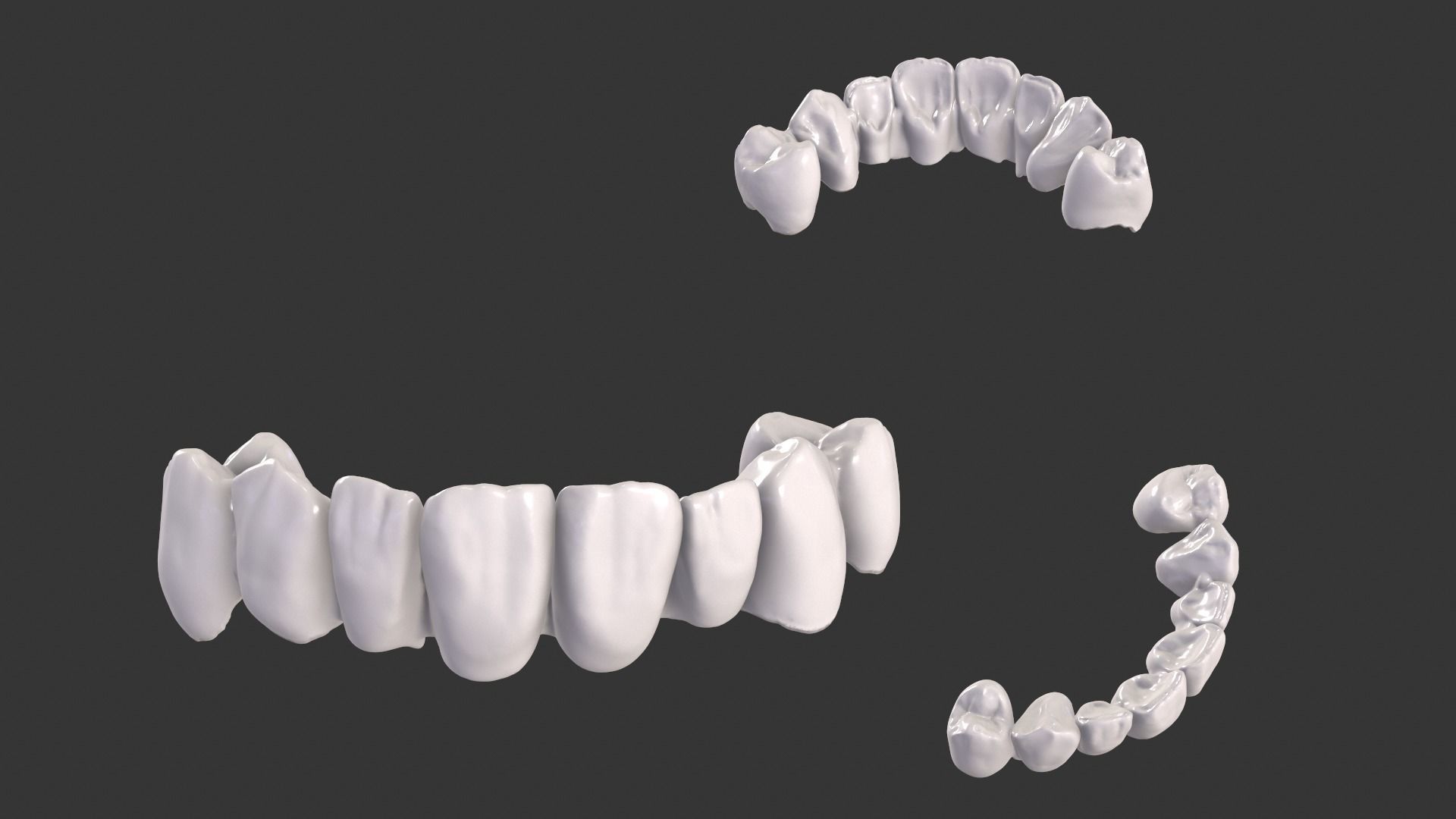 Dental Anatomy Bridge Real medical case  3D print model_3
