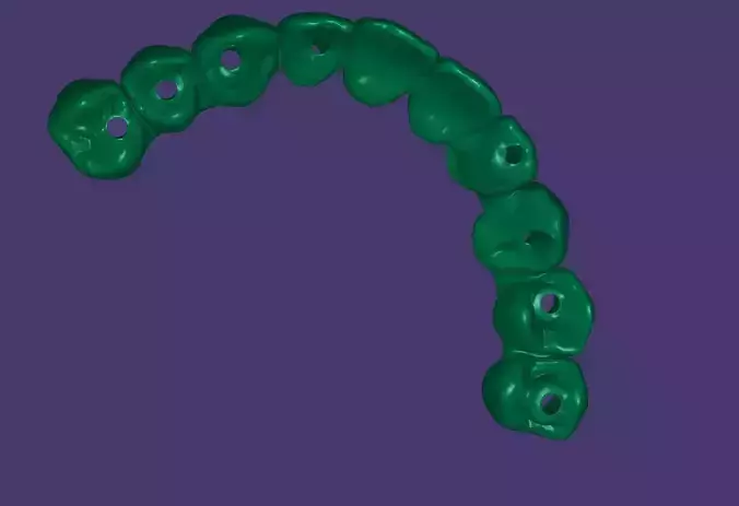  Maxillary Bridge 3D Model 