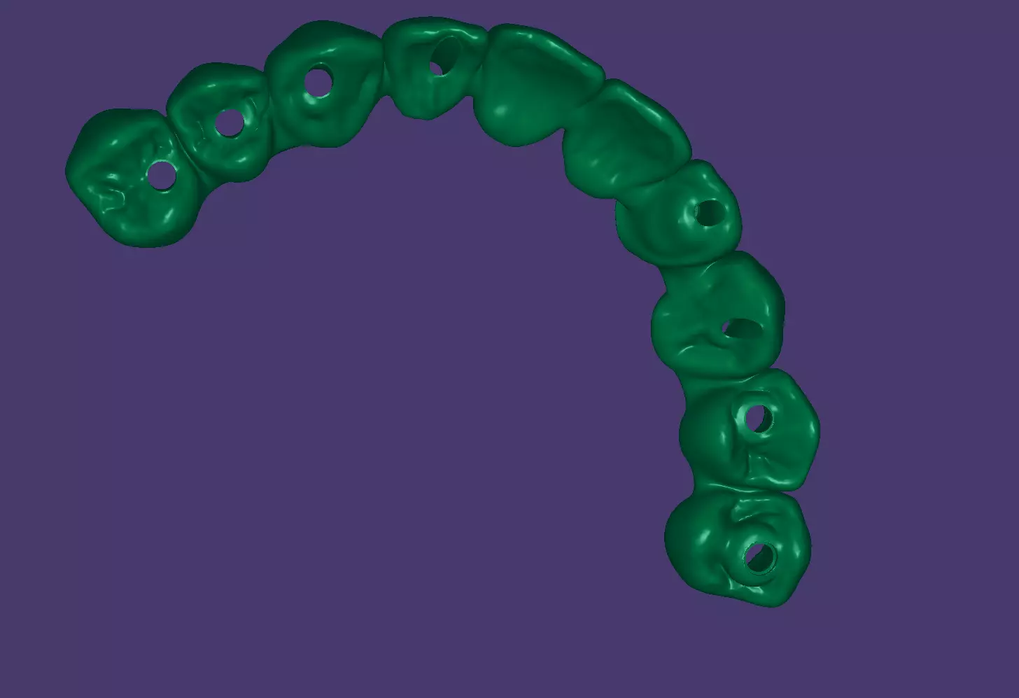 Maxillary Bridge 3D Model 3D print model