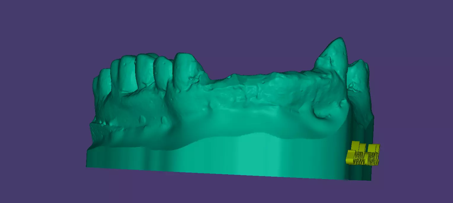 Educational Partial Denture 3D Model for Dental Students 3D model_0