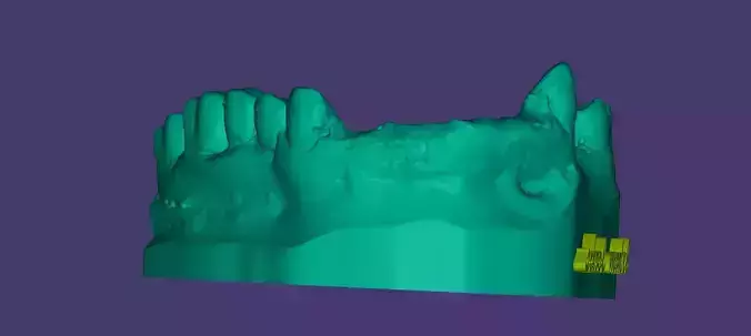  Educational Partial Denture 3D Model for Dental Students
