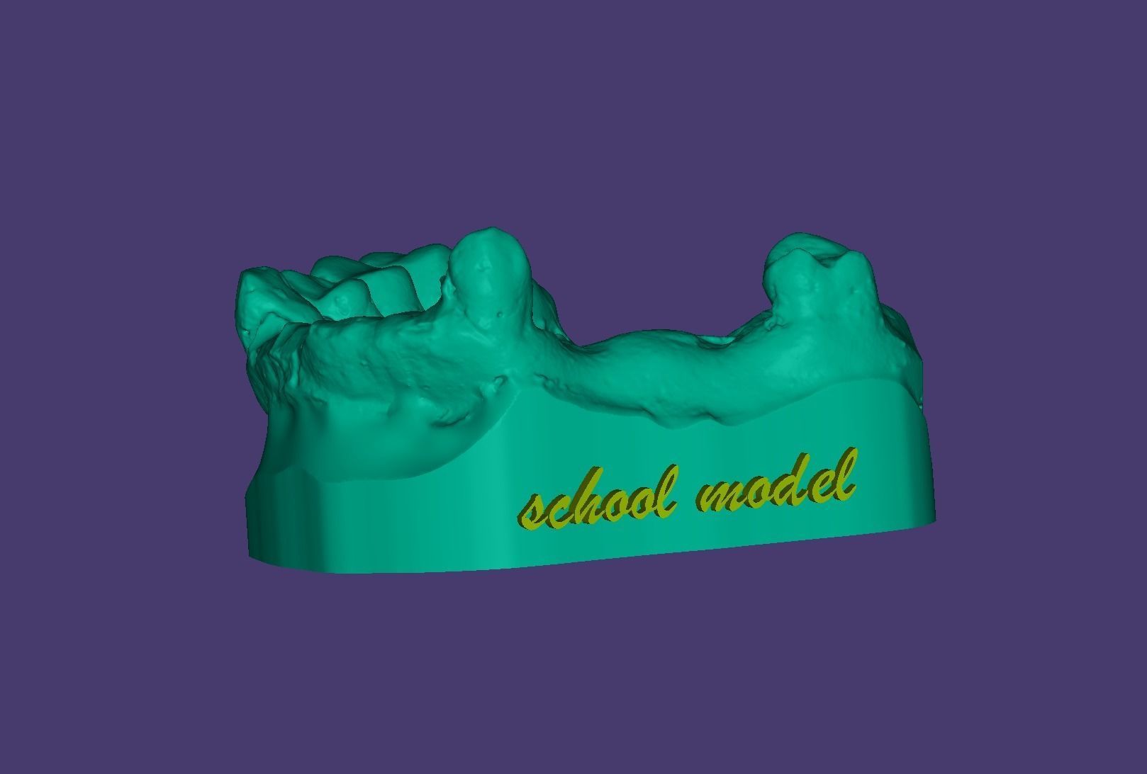 Educational Partial Denture 3D Model for Dental Students 3D model_2