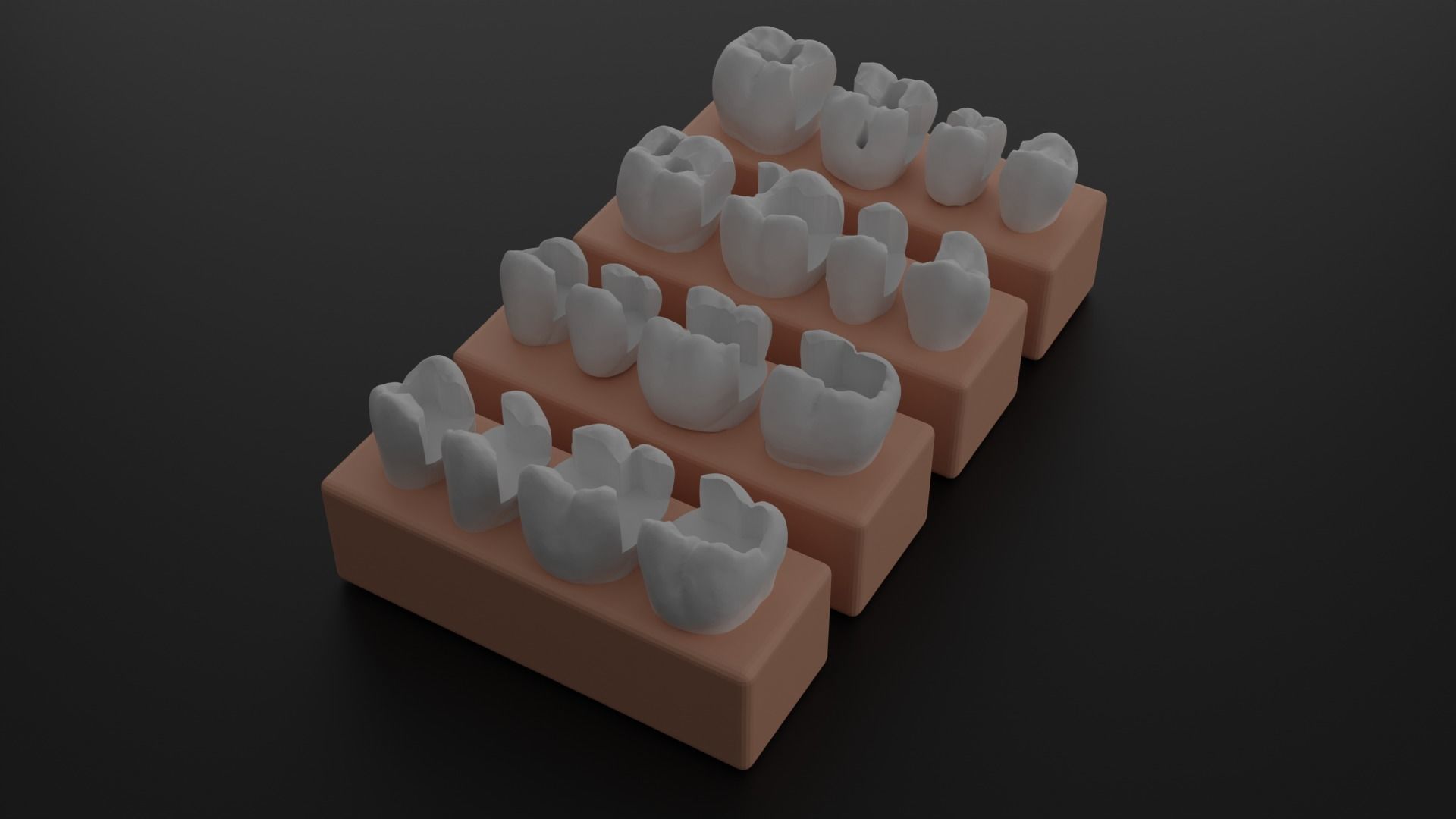 Platform teeth for students 3D print model_5