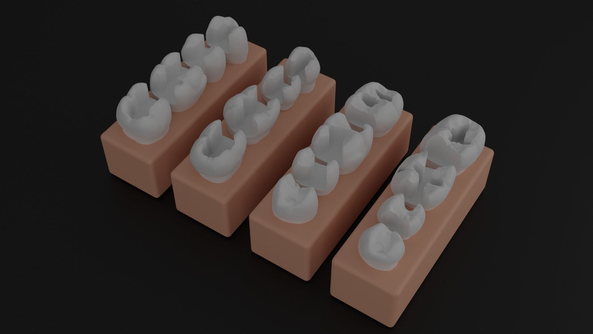 Platform teeth for students 3D print model_4