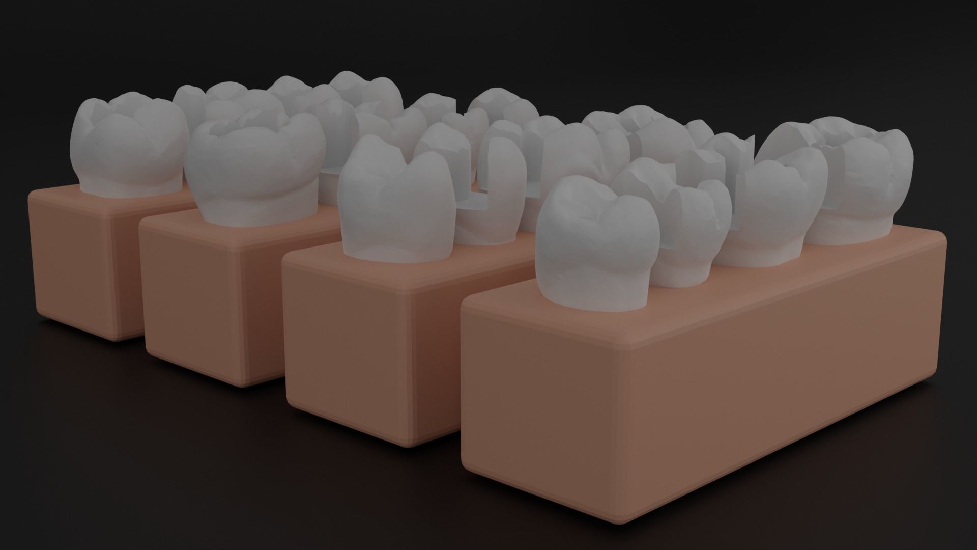 Platform teeth for students 3D print model_8