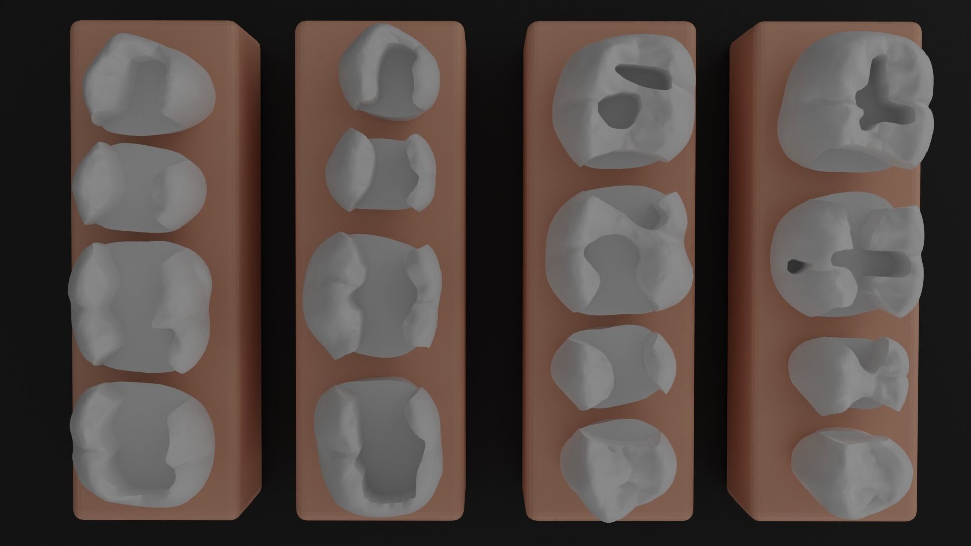 Platform teeth for students 3D print model_2